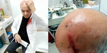 Hasta yakınından doktora taşlı saldırı