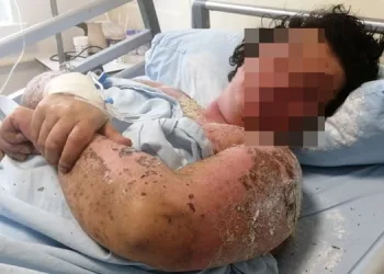 Yanlış antibiyotik kullanımı hayatını kararttı