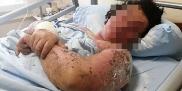 Yanlış antibiyotik kullanımı hayatını kararttı