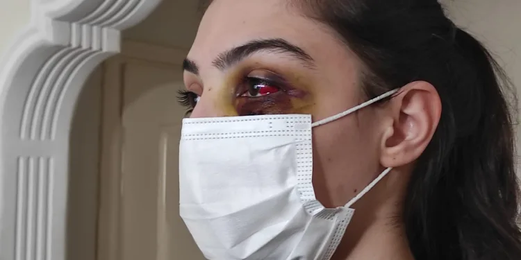 Telefonda video izlediği için kocası tarafından dövüldü