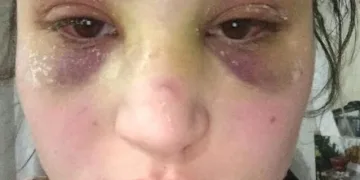 Kaçarak evlendiği kocası, hayatını zindana çevirdi!