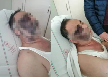 Darbedilen yüzde 90 engelli Mümin Kara yaşamını yitirdi