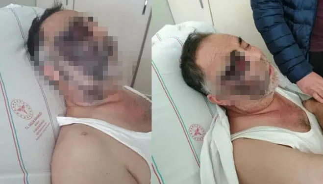 Darbedilen yüzde 90 engelli Mümin Kara yaşamını yitirdi