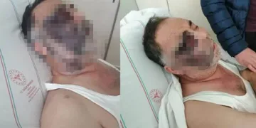 Yüzde 90 engelli adamı öldüresiye darp ettiler