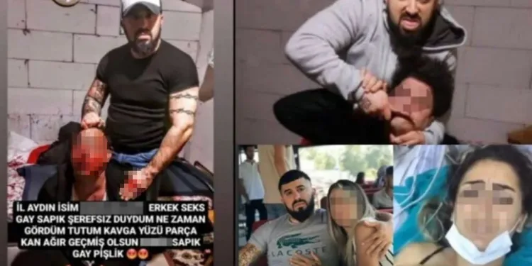 Türkiye’yi ayağa kaldıran görüntü! Engelli genci dövüp sosyal medyada yayınladılar