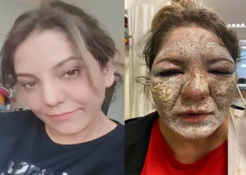 Gittiği güzellik merkezinde kabusu yaşadı