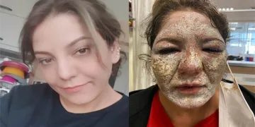 Gittiği güzellik merkezinde kabusu yaşadı