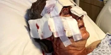 Kafesinden kaçan maymunun saldırısına uğradı