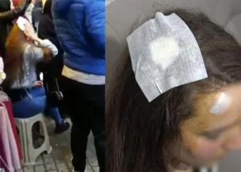 Bursa’da genç kız muştalı saldırıya uğradı