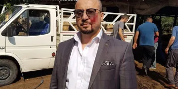 Avukatı yanağından ısırmıştı! Anne ve oğluna hapis