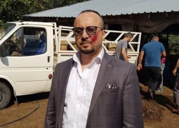 Bursa’da yanağından ısırılan avukat cezaya isyan etti