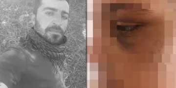Birlikte yaşadığı kadını zincirleyip 6 ay işkence yaptı