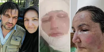 Eşini kızgın yağ ve kaynar su ile yaktı