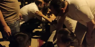 Kazada ayağı koptu, kimse gerçeği söyleyemedi