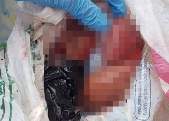 Sokakta düşük yapan kadın, bebeğini çöpe attı