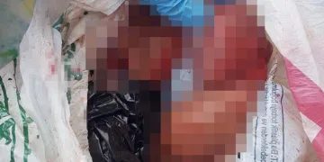 Sokakta düşük yapan kadın, bebeğini çöpe attı