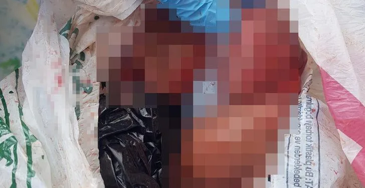 Sokakta düşük yapan kadın, bebeğini çöpe attı