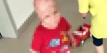 Yangında annesini kaybetti, iki eli bileklerinden kesildi