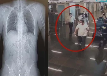 Midesinde 3 kilo uyuşturucuyla yakalandı