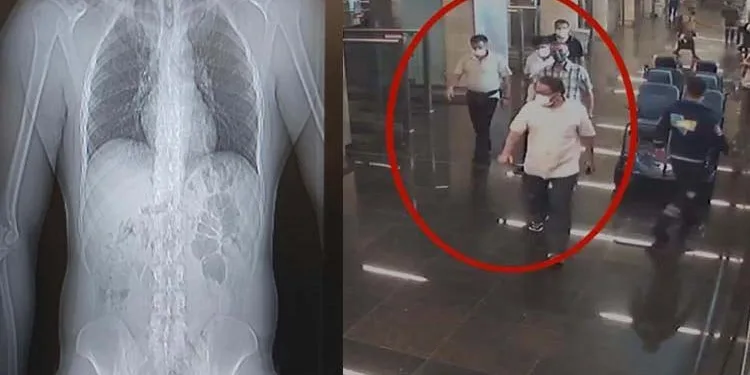 Midesinde 3 kilo uyuşturucuyla yakalandı