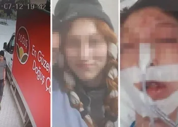 Cinsel istismara kalkıştı, başına taşla vurdu