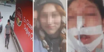 Cinsel istismara kalkıştı, başına taşla vurdu