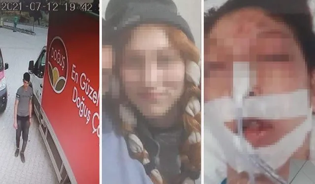Cinsel istismara kalkıştı, başına taşla vurdu