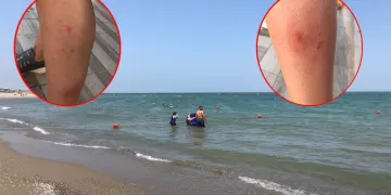 Denize girenler hastanelik olmuştu: Nedeni belli oldu