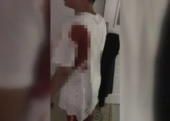 Çivi sandı, yorgun mermi çıktı