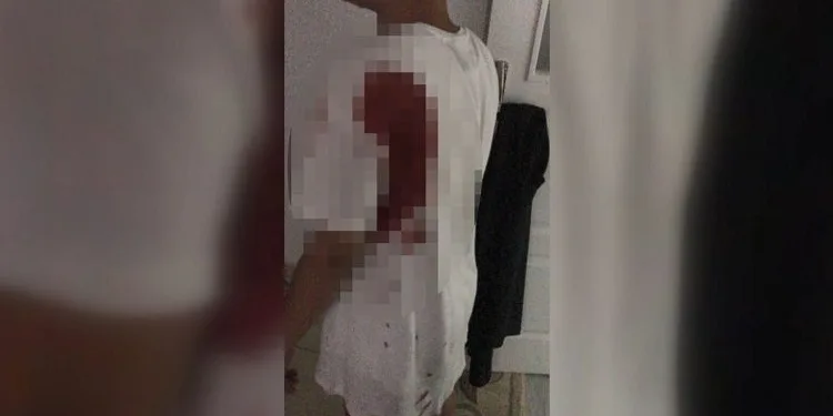 Çivi sandı, yorgun mermi çıktı