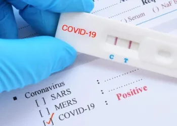 PCR testleri ücretli mi olacak?