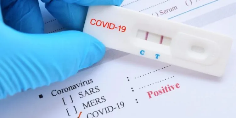 PCR testleri ücretli mi olacak?