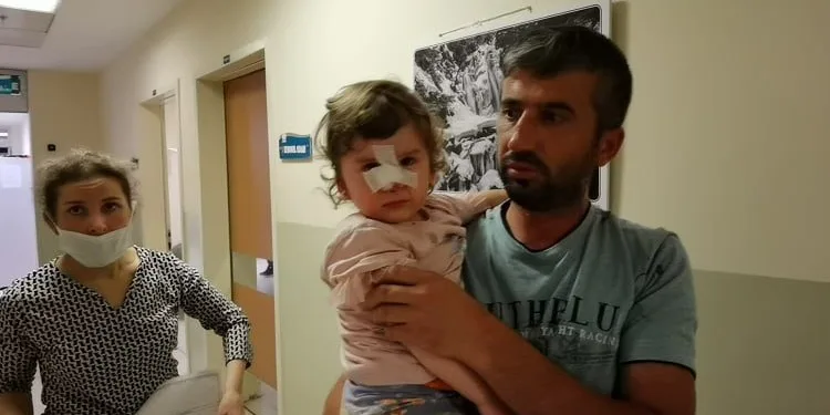 Bursa’da 2 yaşındaki çocuğa saldıran köpeğin sahibi aranıyor
