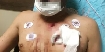 Uygunsuz fotoğraflarını paylaşan erkek arkadaşını göğsünden bıçakladı