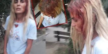 “Ölmek istemiyorum” demişti, sopayla dövüldü