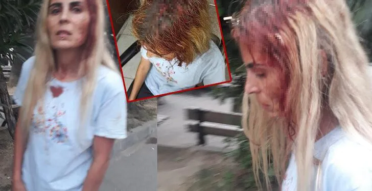 “Ölmek istemiyorum” demişti, sopayla dövüldü