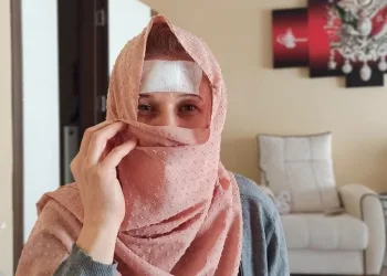 Bursa’da hırsızın bıçakladığı kadın konuştu