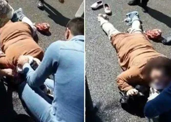Boşanma aşamasındaki eşini sokakta vurdu