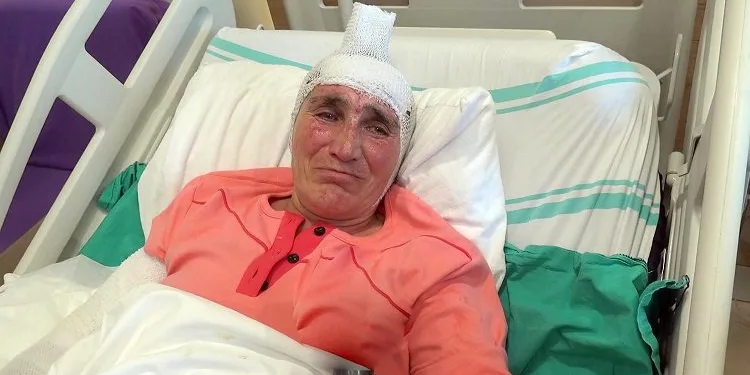 Ekmek pişirirken tandıra düştü: Köye bir daha adım bile atmam