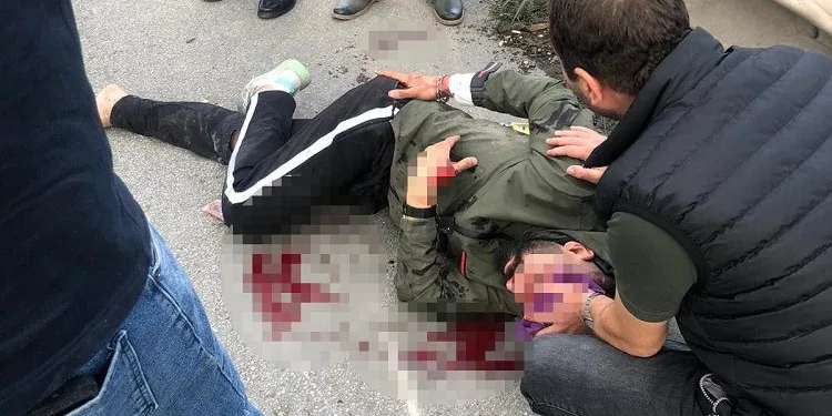 Bursa’da motosiklet sürücüsü kazada ağır yaralandı