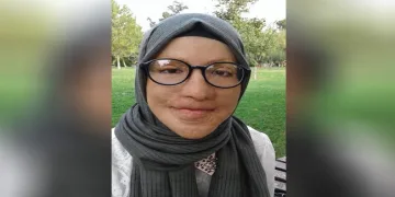 Mucize değişim! 19 yılda 45 ameliyat geçirdi