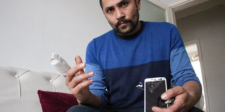 Patlyan powebank parmağını kopardı