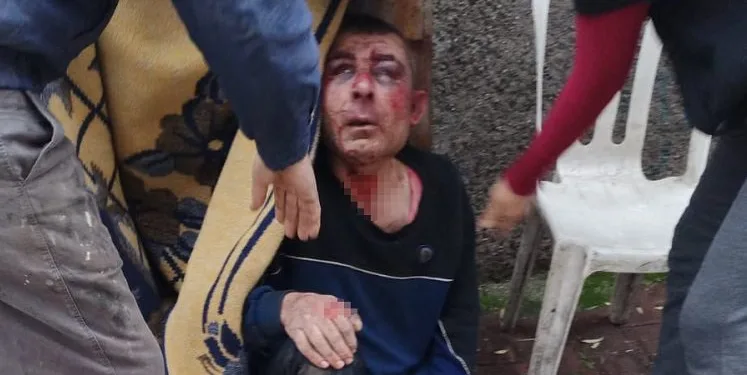 Öldüresiye dövüp evinin önüne bıraktılar