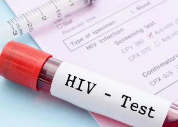 AIDS vakaları iki katına çıkabilir