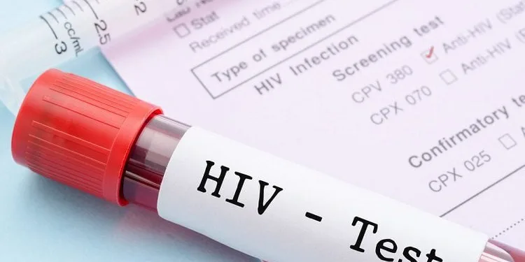 AIDS vakaları iki katına çıkabilir