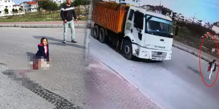 Köpekten kaçarken kamyon çarpmıştı! Sağ bacağı kesildi