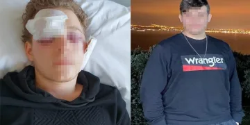 Silahla oynarken arkadaşını vurdu! Gözlerini kaybetti