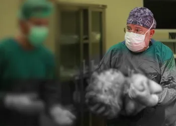 Hastanın karnından çıktı! 40 yıllık doktor bile şaşırdı