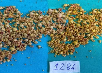 Karın ağrısı şikayetiyle gitti hepsi safra kesesinden çıktı