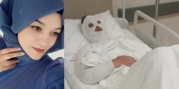 Eski nişanlısına kezzap attı